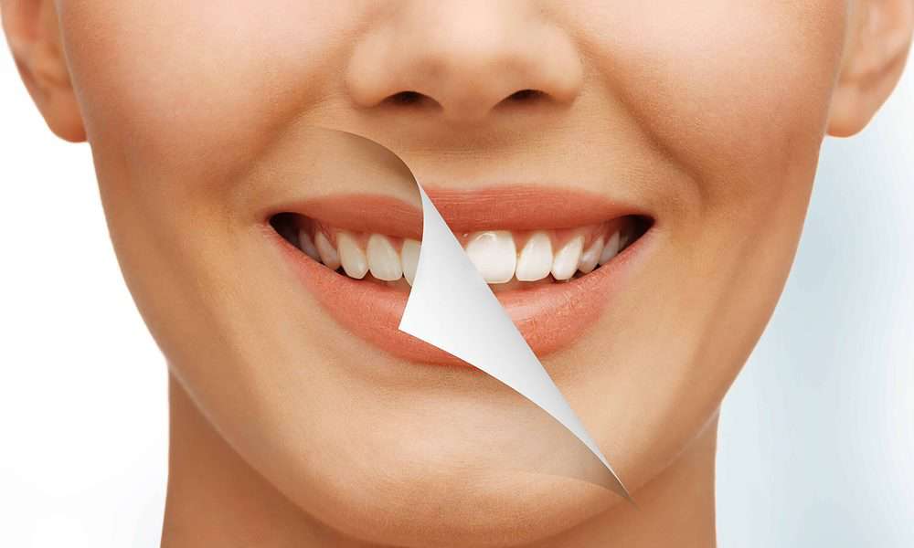 Whitening Special